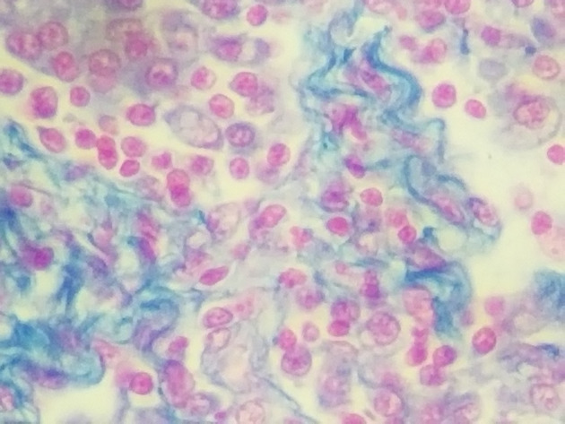 Reticular Connective Slides - Reticular Connective 06 400X